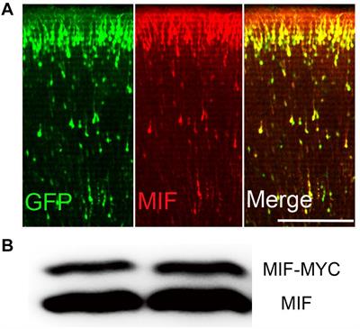 Profile of MIF in Developing Hippocampus: Association With Cell Proliferation and Neurite Outgrowth